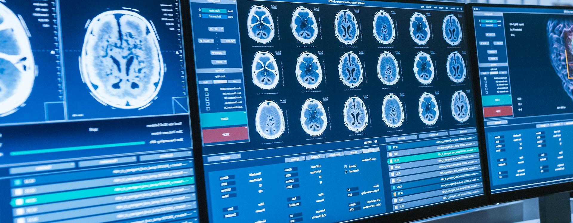 Computer monitors showing results of medical test